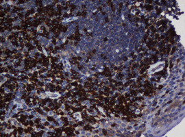 UBE2J1 Antibody in Immunohistochemistry (Paraffin) (IHC (P))