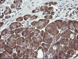 UBE2J1 Antibody in Immunohistochemistry (Paraffin) (IHC (P))