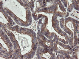 UBE2J1 Antibody in Immunohistochemistry (Paraffin) (IHC (P))