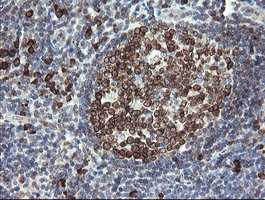 UBE2J1 Antibody in Immunohistochemistry (Paraffin) (IHC (P))