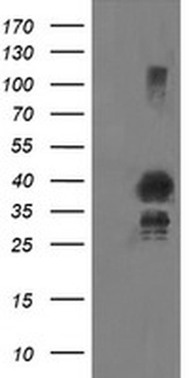 UBE2J1 Antibody in Western Blot (WB)