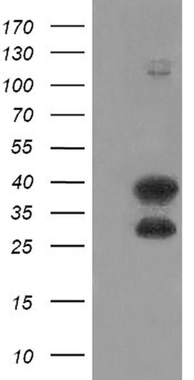 UBE2J1 Antibody in Western Blot (WB)