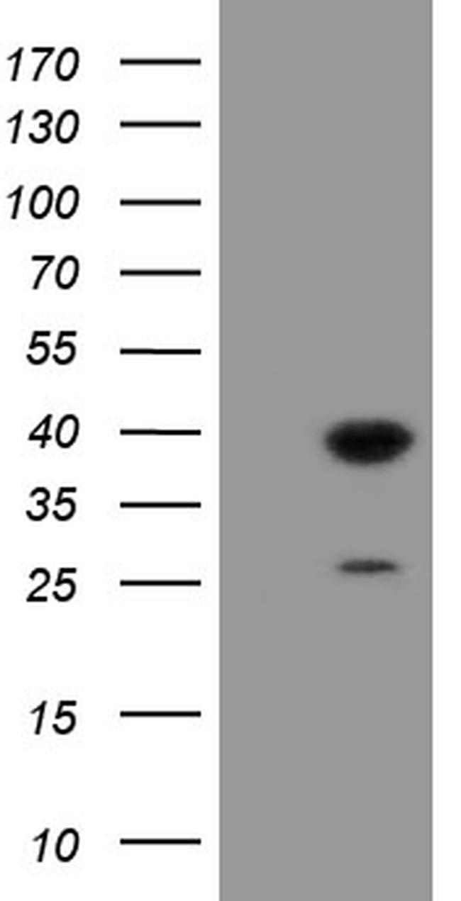 UBE2J1 Antibody in Western Blot (WB)