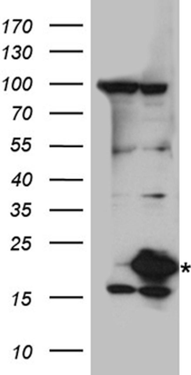 UBE2L3 Antibody in Western Blot (WB)