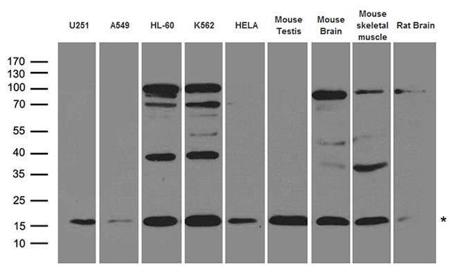 UBE2L3 Antibody in Western Blot (WB)