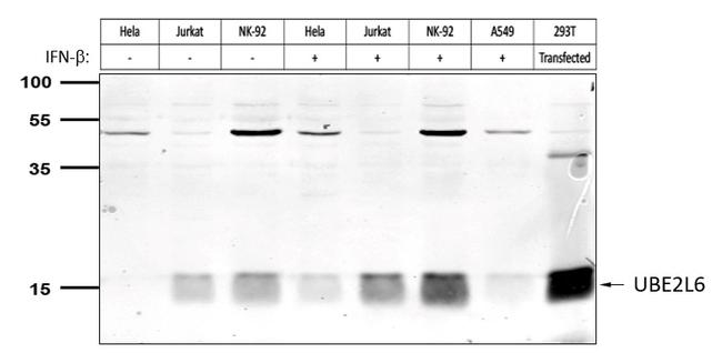 UBE2L6 Antibody in Western Blot (WB)