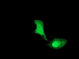 UBE2M Antibody in Immunocytochemistry (ICC/IF)