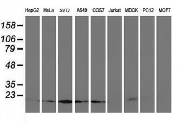 UBE2M Antibody in Western Blot (WB)