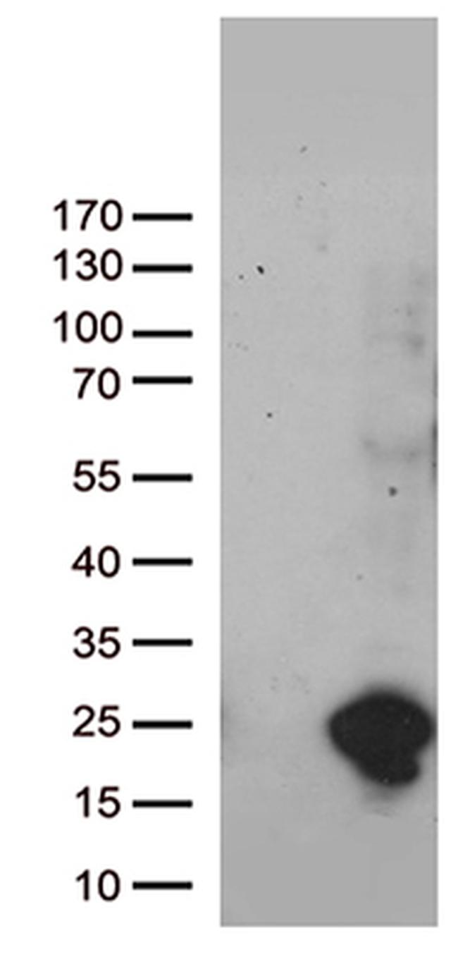 UBE2NL Antibody in Western Blot (WB)