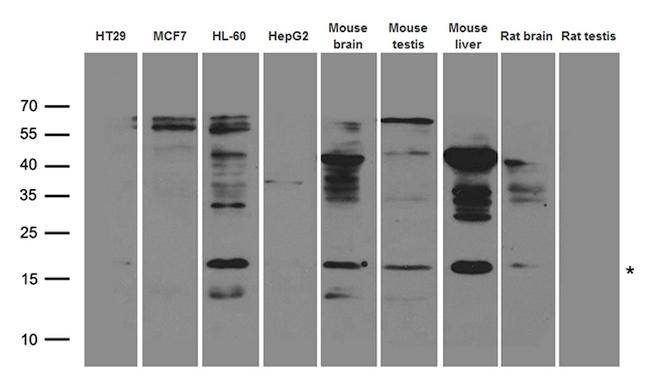 UBE2NL Antibody in Western Blot (WB)