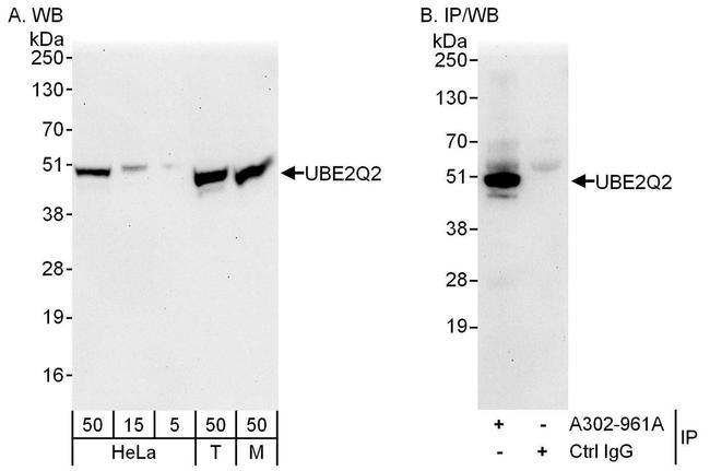 UBE2Q2 Antibody in Western Blot (WB)