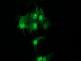 UBE2S Antibody in Immunocytochemistry (ICC/IF)