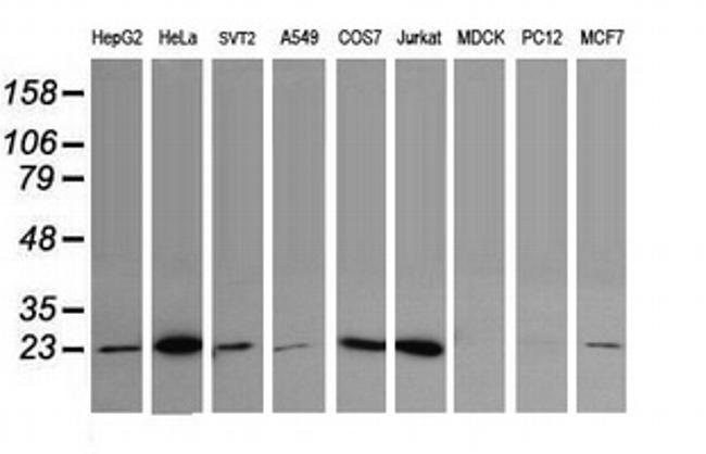 UBE2S Antibody in Western Blot (WB)