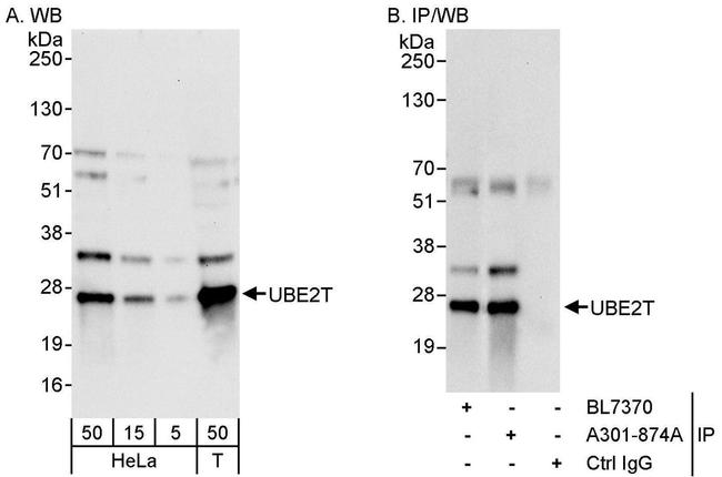 UBE2T Antibody in Western Blot (WB)