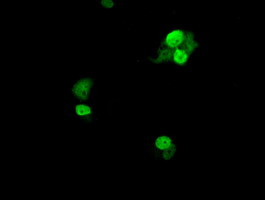 UBE2T Antibody in Immunocytochemistry (ICC/IF)