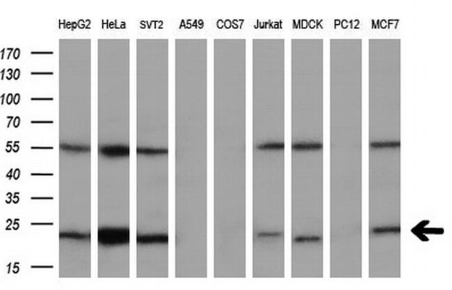 UBE2T Antibody in Western Blot (WB)