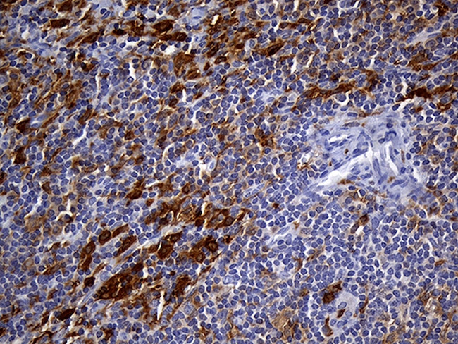 UBE3B Antibody in Immunohistochemistry (Paraffin) (IHC (P))