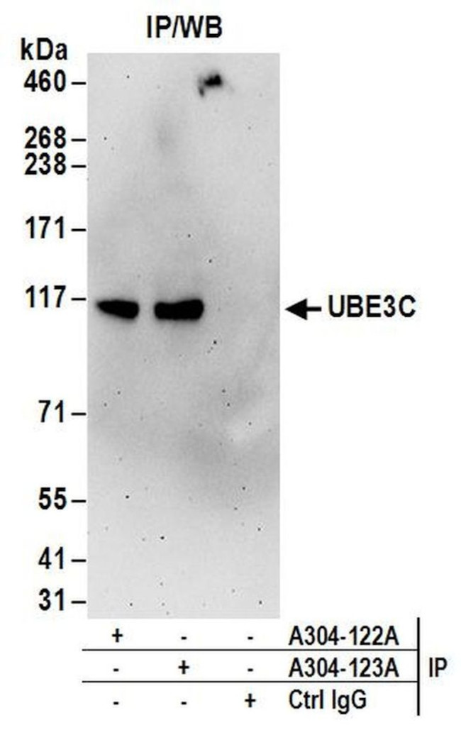 UBE3C Antibody in Immunoprecipitation (IP)