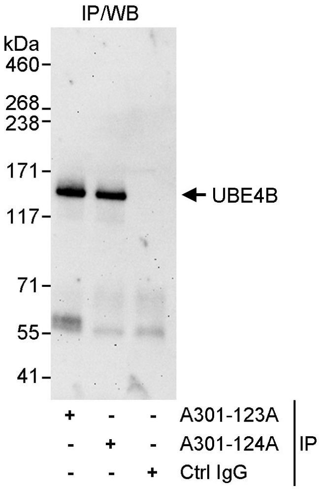 UBE4B Antibody in Immunoprecipitation (IP)