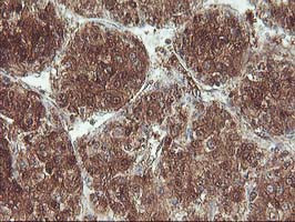 UBOX5 Antibody in Immunohistochemistry (Paraffin) (IHC (P))