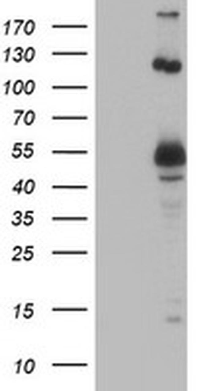 UBOX5 Antibody in Western Blot (WB)