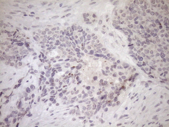 UBP1 Antibody in Immunohistochemistry (Paraffin) (IHC (P))