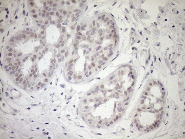 UBP1 Antibody in Immunohistochemistry (Paraffin) (IHC (P))