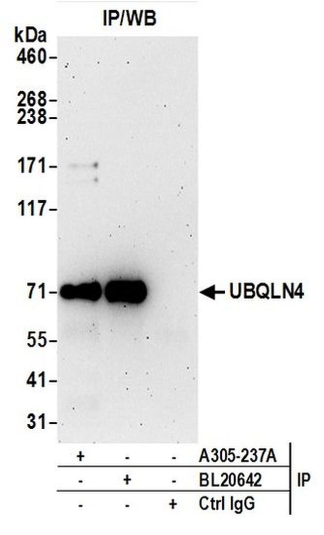 UBQLN4/CIP75/Ubiquilin 4 Antibody in Western Blot (WB)