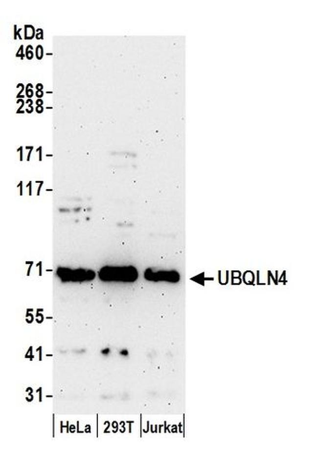 UBQLN4/CIP75/Ubiquilin 4 Antibody in Western Blot (WB)