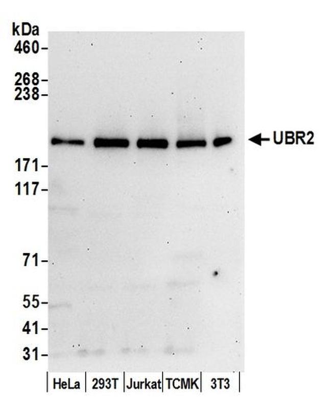 UBR2 Antibody in Western Blot (WB)