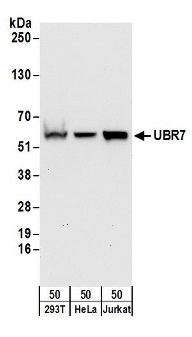 UBR7 Antibody in Western Blot (WB)