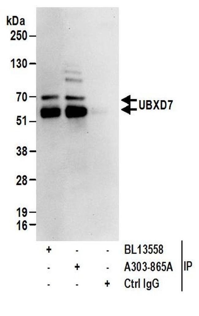 UBXD7 Antibody in Western Blot (WB)