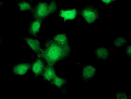 UBXN2B Antibody in Immunocytochemistry (ICC/IF)