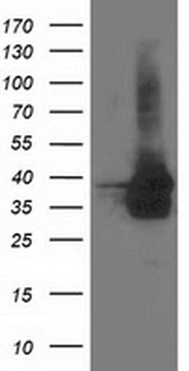 UBXN2B Antibody in Western Blot (WB)