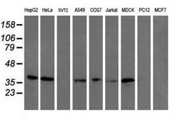 UBXN2B Antibody in Western Blot (WB)