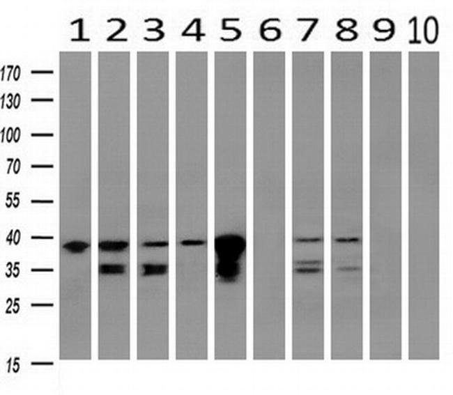 UBXN2B Antibody in Western Blot (WB)