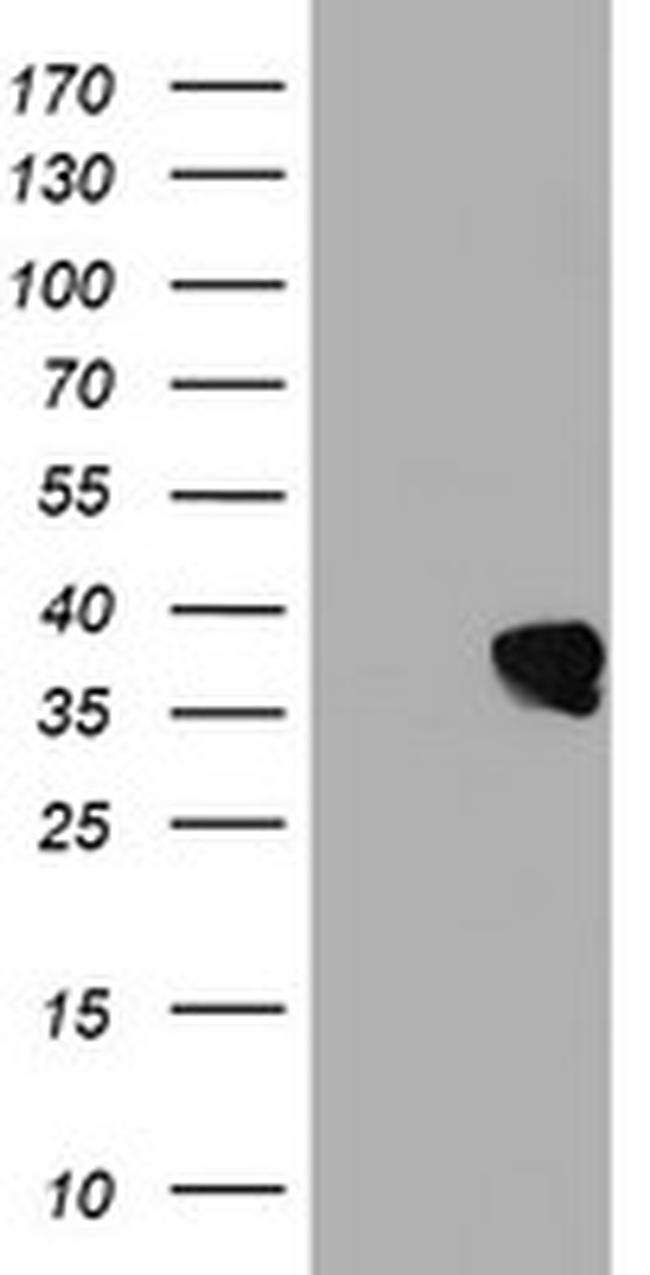 UBXN2B Antibody in Western Blot (WB)