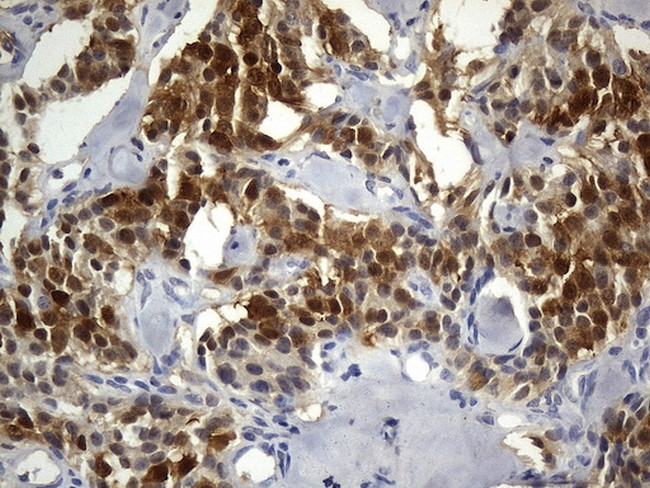 UCHL1 Antibody in Immunohistochemistry (Paraffin) (IHC (P))