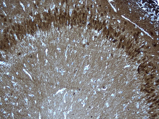 UCHL1 Antibody in Immunohistochemistry (Paraffin) (IHC (P))