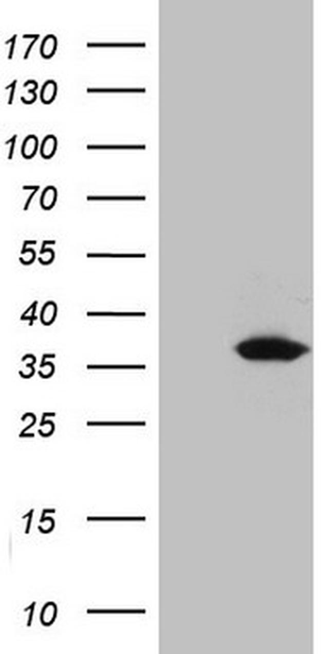 UCK2 Antibody in Western Blot (WB)