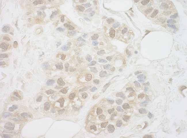 UCKL1 Antibody in Immunohistochemistry (IHC)