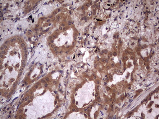 UFD1L Antibody in Immunohistochemistry (Paraffin) (IHC (P))