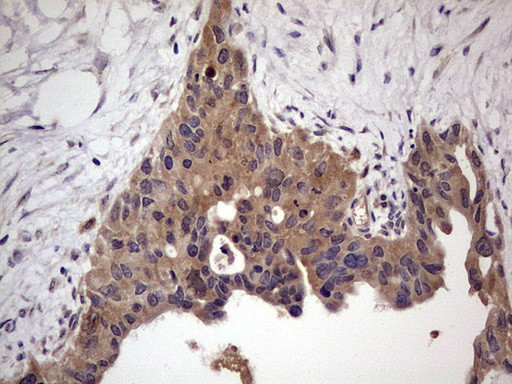 UFD1L Antibody in Immunohistochemistry (Paraffin) (IHC (P))