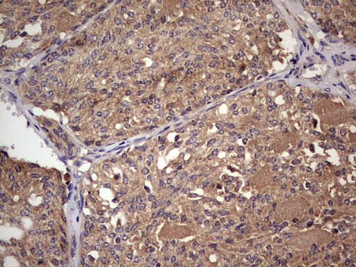 UFD1L Antibody in Immunohistochemistry (Paraffin) (IHC (P))