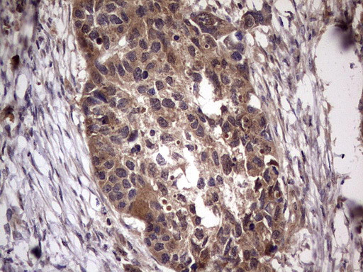 UFD1L Antibody in Immunohistochemistry (Paraffin) (IHC (P))