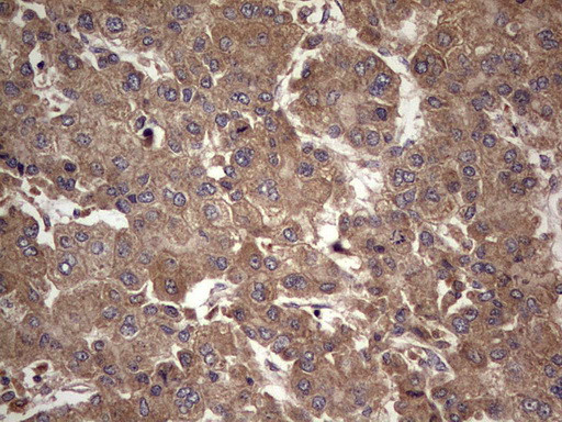 UFD1L Antibody in Immunohistochemistry (Paraffin) (IHC (P))