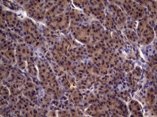 UFD1L Antibody in Immunohistochemistry (Paraffin) (IHC (P))