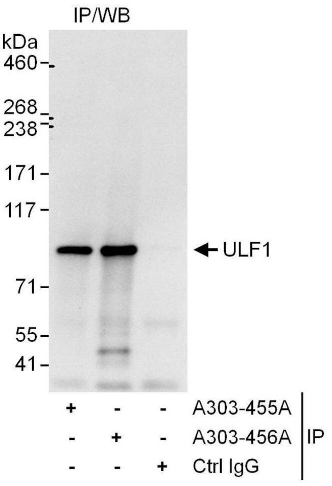 UFL1 Antibody in Immunoprecipitation (IP)