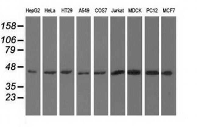 UHMK1 Antibody in Western Blot (WB)