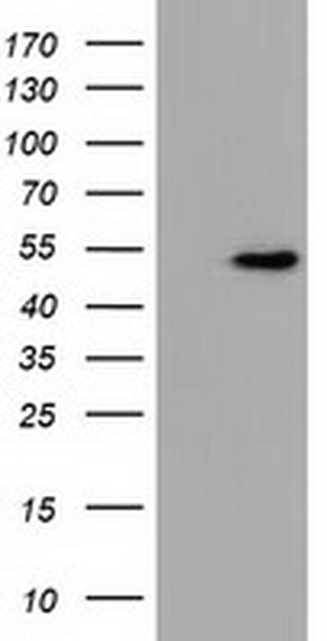 UHMK1 Antibody in Western Blot (WB)